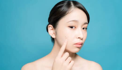 上野でニキビ跡治療が安い・人気のクリニック10院！レーザー治療が良い？市販薬か皮膚科の治療の違いは？