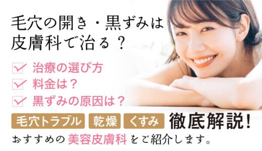毛穴の黒ずみ・開きは皮膚科に行くべきか？鼻の黒ずみ・顔の毛穴の開きがひどい時の治療法・料金など徹底解説