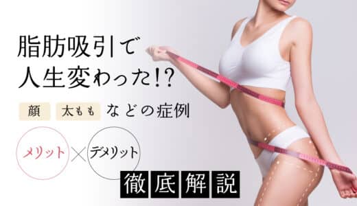 脂肪吸引で人生変わった！？顔や太ももなどの症例やメリット・デメリット、人気クリニックを紹介
