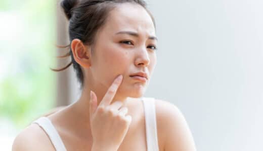 千葉でニキビ跡治療が安い・人気のクリニック10院！レーザー治療が良い？市販薬か皮膚科の治療の違いは？