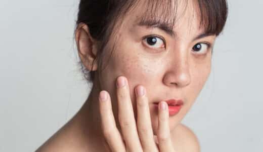 熊本で毛穴治療が安い美容皮膚科を10院ご紹介します！毛穴の開きや毛穴の黒ずみが気になる方は必見！