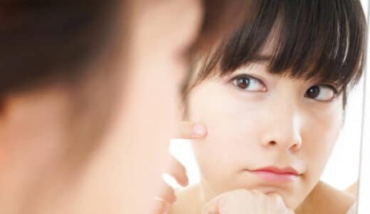 大宮でニキビ跡治療が安い・人気のクリニック11院！レーザー治療が良い？市販薬か皮膚科の治療の違いは？
