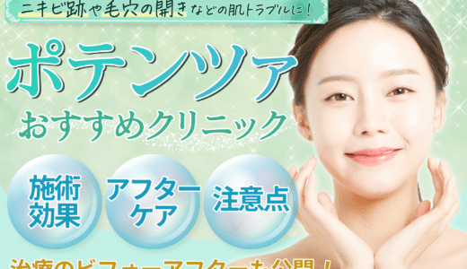 ポテンツァの安いおすすめクリニック12院紹介！効果ない？痛い？施術結果から、後悔しない選び方まで詳しく解説