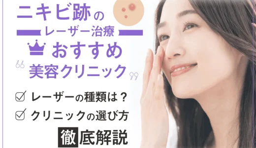 ニキビ跡治療がおすすめ安い美容皮膚科！保険適用になる治療は？赤み・クレーターに対する治療の効果を解説